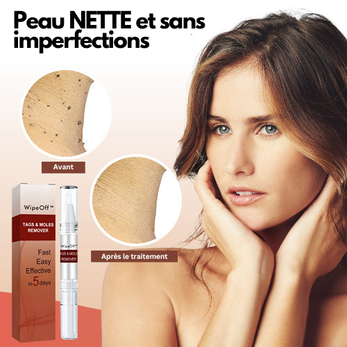 SkinClear™ - Dissolvant de verrues et de taches (1+1 GRATUIT)