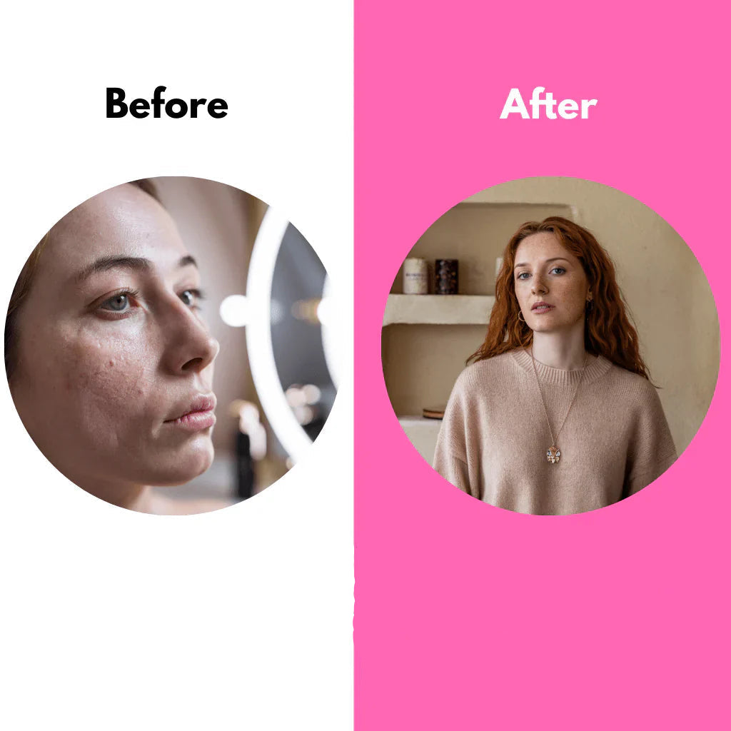 Silkrēa - Offre un lissage instantané de la peau pour un éclat naturel parfait