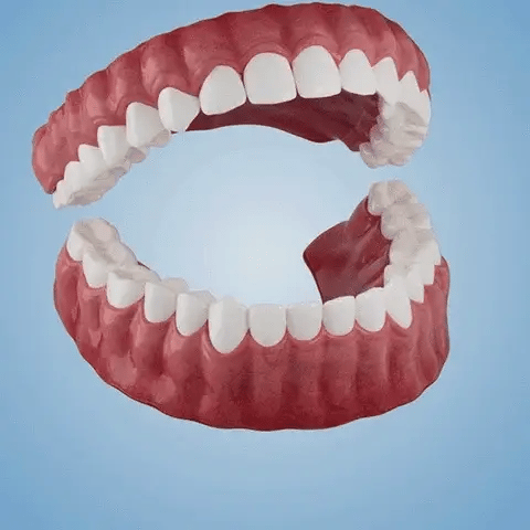 SmileShade - Camouflez rapidement les imperfections dentaires pour un sourire parfait