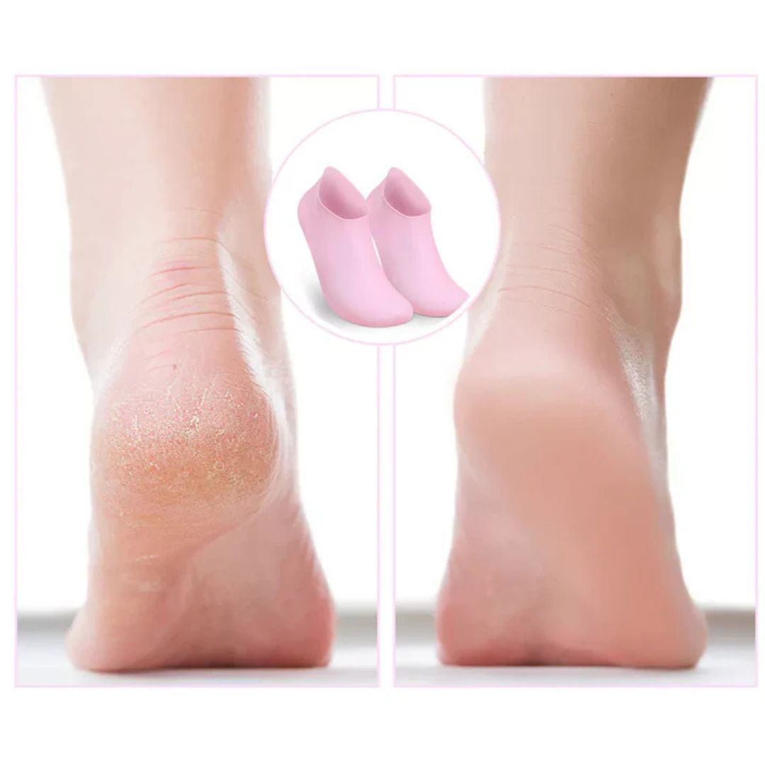 SilkSole - Chaussettes de Pédicure Hydratantes en Silicone