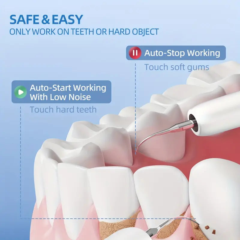 DentaLume™ – Détartreur Dentaire Électrique avec Lumière LED et Recharge USB