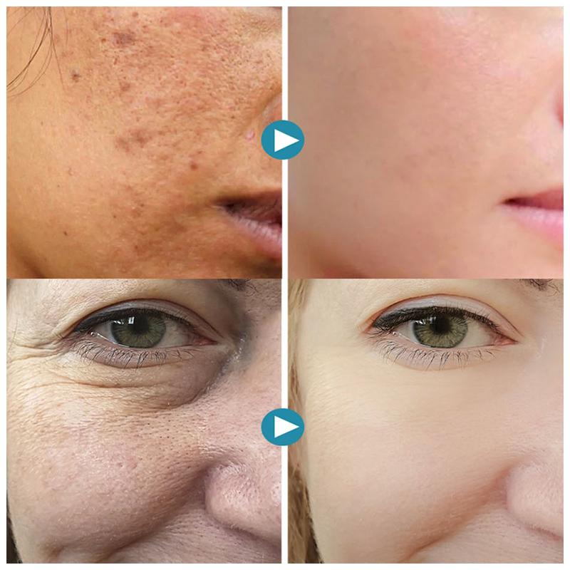 Silkrēa - Offre un lissage instantané de la peau pour un éclat naturel parfait