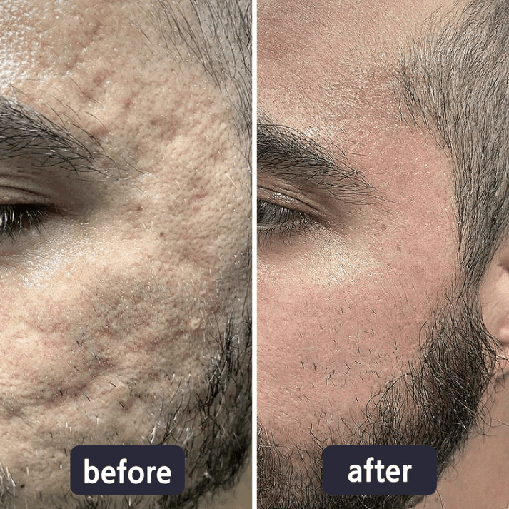 GlowVive - Estomper rapidement les cicatrices et raffermir la peau pour un éclat jeunesse