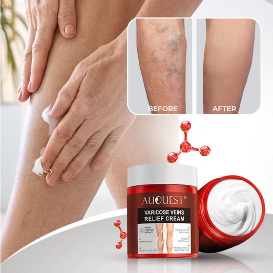 VeinoGel™️ - Varicose Veins Relief Cream by Auquest®️