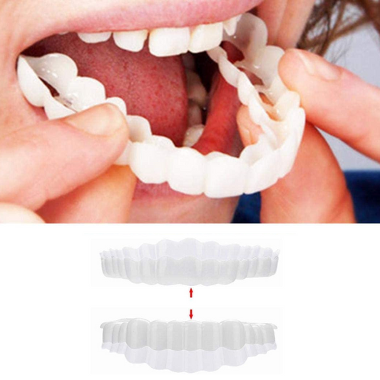 Smile Veneer for Perfect Teeth - Upper & Lower Included